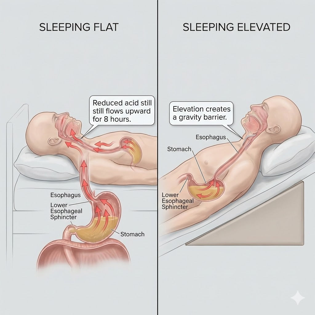 Medical diagram showing stomach acid rising to the larynx when lying flat vs. staying down at 30&deg; elevation